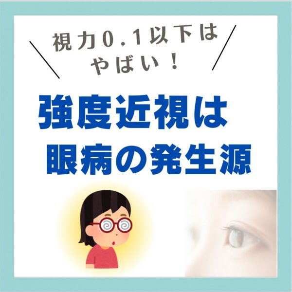 強度近視は眼病の発生源